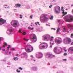 Naegleria