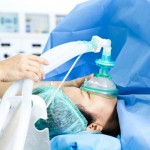 General Anesthesia