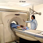 Computed Tomography (CT) Scans