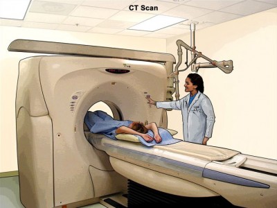 Computed Tomography (CT) Scans