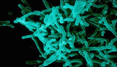 healthdiphtheriainPunjabPakistan_12-9-2015_206801_l. [downloaded with 1stBrowser]