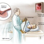 Gastroscopy