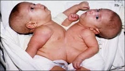 Children Complex  pelvis to Multan