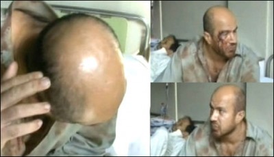 Sangla Hill hostage rescue, wires lips stood out