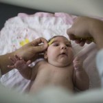 Zika Birth Defects
