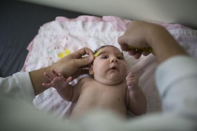 Zika Birth Defects