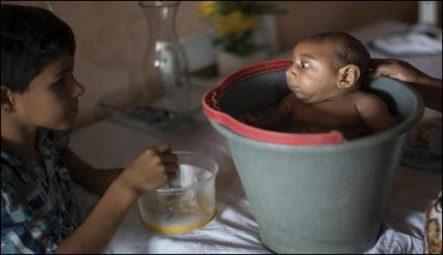 Zyka Ebola virus can be greater