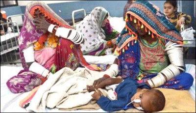 Thar: malnutrition further 3 children died, 