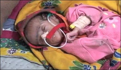 Putting children to death 