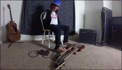 The young man lost both arms