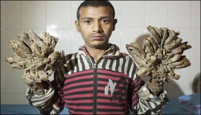 Bangladeshi teenager