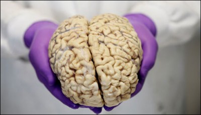 Iran: research on the nervous