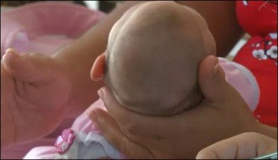 To counter zyka needs