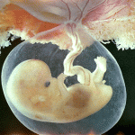 Embryonic