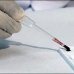 Faisalabad, first congo virus effectee diagnosed