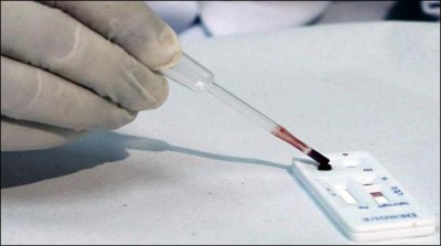 Faisalabad, first congo virus effectee diagnosed