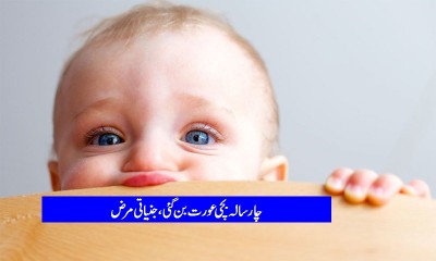 Four- year-old girl got adult because of harmones problem