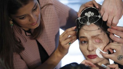 indina-girl-effected-with-acid-walked-on-the-ramp