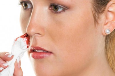 nose-bleeding-may-be-even-more-dangerous2