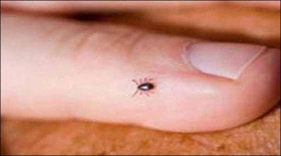 Quetta, Congo virus effect died