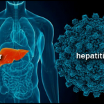 New hepatitis C drug cured 10 million people in the Third World