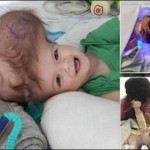 Srjry children in the US operation