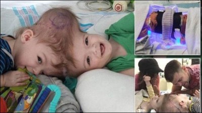 Srjry children in the US operation