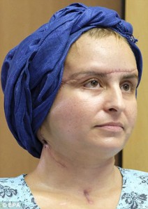 Successful face transplant woman suffering from a mysterious illness