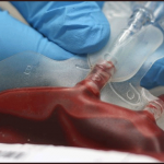 Old mice were grown from human blood transfusion