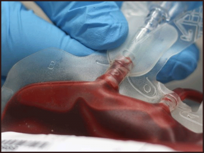 Old mice were grown from human blood transfusion