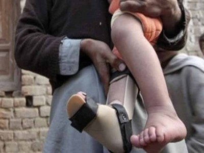 By the end of this year Pakistan will become the polio free country, the United Nations