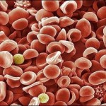 KP to start using the new drug thalassemia