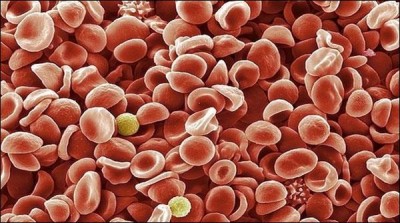 KP to start using the new drug thalassemia