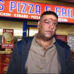 LONDON worst incident of racism, the acid attacks on Muslims`
