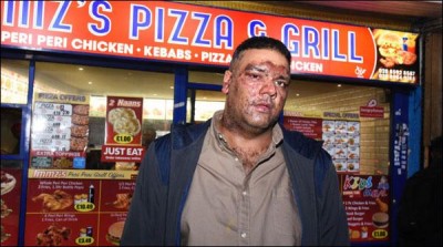 LONDON worst incident of racism, the acid attacks on Muslims`
