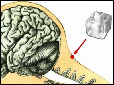 Ancient and wonderful treatment with snow