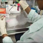 Scientists claim to treat prostate cancer