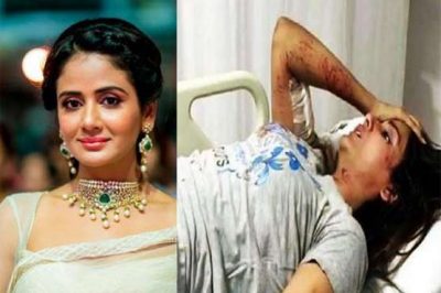 Attacked by stray dogs on Indian actress Parul Yadav, seriously injured