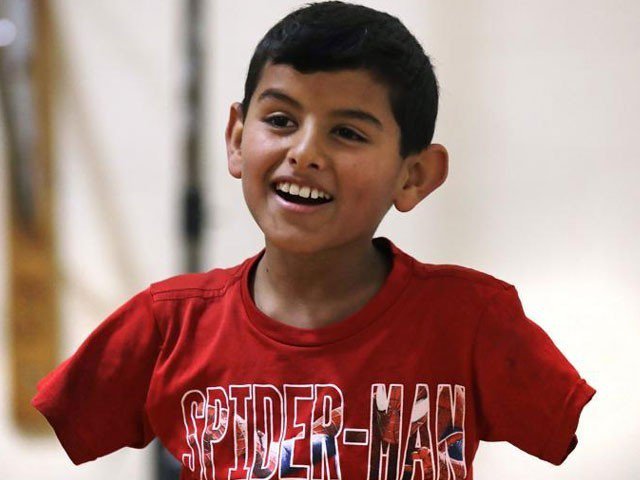 Lost both arms Syrian children looking for his Parents in Usa