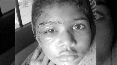 Islamabad: agree on the issue of alleged torture of maid Costume