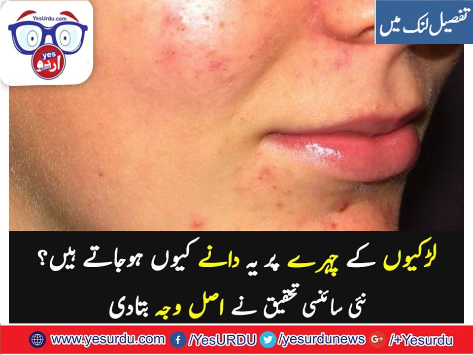 آپ کی پلکیں ننھے کیڑوں کا گھر