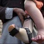 LODHRAN, 1ST, POLIO, CASE OF, 2017, REGISTERED