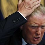 Donald Trump used medicines for his hair, doctors claims
