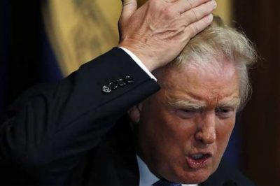 Donald Trump used medicines for his hair, doctors claims