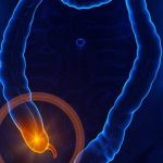 ANTI BIOTECH, MEDICINE, ARE, HELPFUL, IN, CURING, APPENDICES,