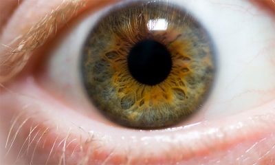 WHY, PIMPLES, APPEAR, ON, YOUR, FACE