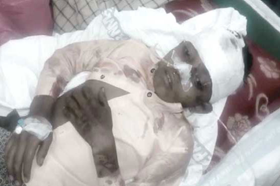 Mian channu: Two childrens burnt with injured when fire in a passenger van