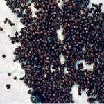 1,600 gallstones removed from woman’s bile duct
