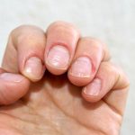 They ,show, signs ,of ,nails,that, the, risk, of, various ,diseases