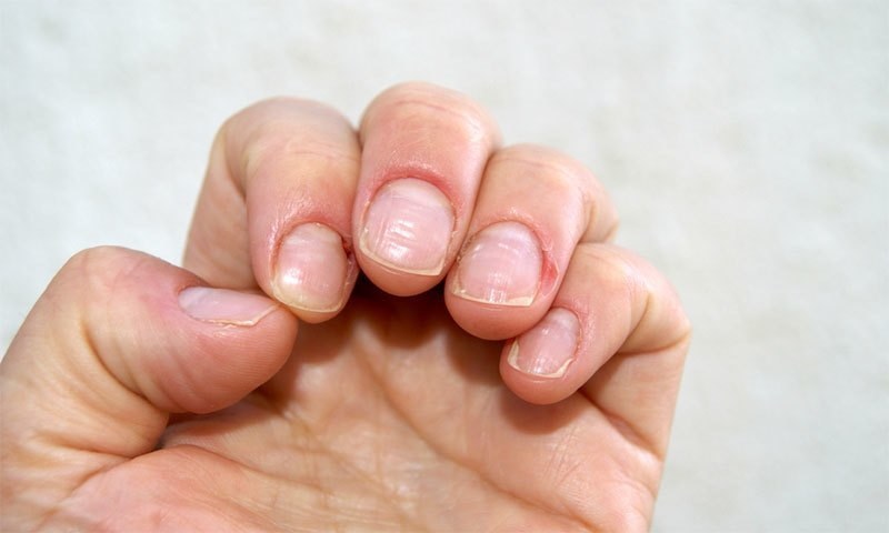 They ,show, signs ,of ,nails,that, the, risk, of, various ,diseases